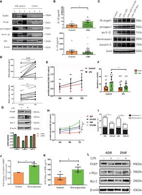 NLRP3 Inflammasome Promotes the Progression of Acute Myeloid Leukemia via IL-1β Pathway